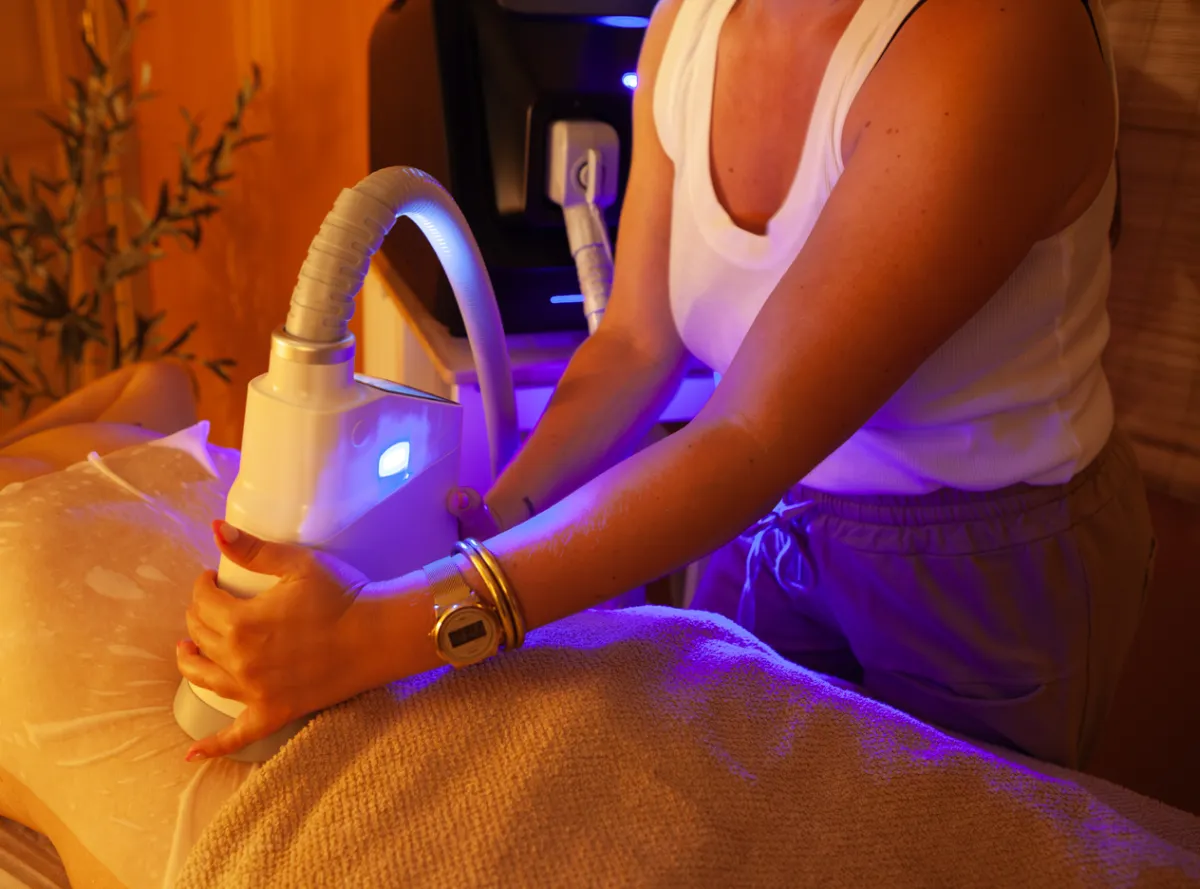 Colocación del cabezal de criolipólisis SIWA Cryo Sculpt en Rubí